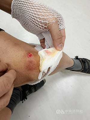 北市男通緝犯遇盤查逃逸遭逮、友人傷警　均送辦