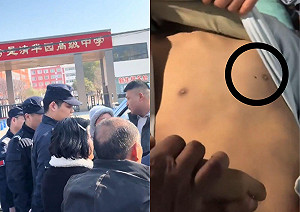 河南少年死狀太驚悚！家屬崩潰曝遺照求真相 專業人士剖析：胸口釘子洞疑遭穿刺