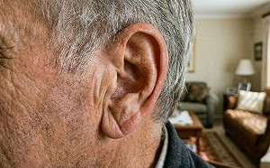 別以為只是老了！耳朵出現摺痕恐是心血管危機？醫曝關鍵