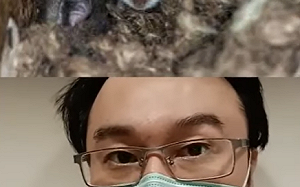 今年首例亡！漢他病毒可怕在初期「太像風寒」 胸腔醫點名這「4類人」最危險