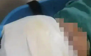 送去管教竟變送進ICU! 湖北13歲男童在「成長基地」被打到失明骨折