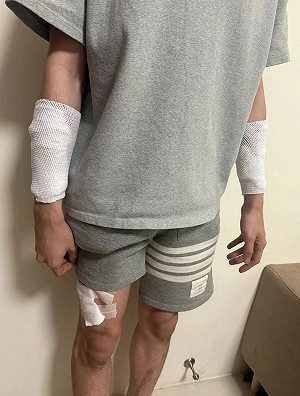 苗栗護理師遭隨機砍傷是假的！警方調查大逆轉 自導自演想「討拍」