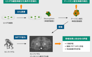 帕金森氏症有救星？日本擬iPS細胞治療創全球首例
