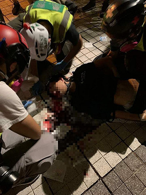 反送中傷亡頻傳 15歲少年頭部中催淚彈危殆、荃灣有黑衣人墜樓亡