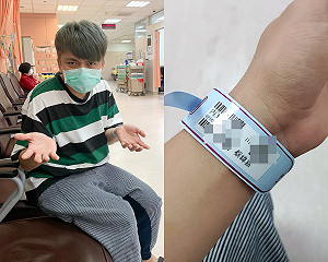 蔡阿嘎換染劑半夜掛急診紅癢無法入睡 粉絲：黑髮就很好看