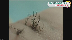 生髮新技術成功！大量培植毛囊細胞可行