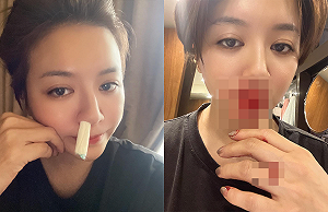 滿臉鮮血！李妍憬曝原因 網笑：你鼻血會止不了