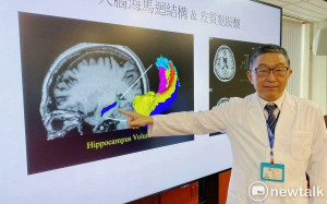 台中榮總創新研究 思覺失調症有望科學化診療
