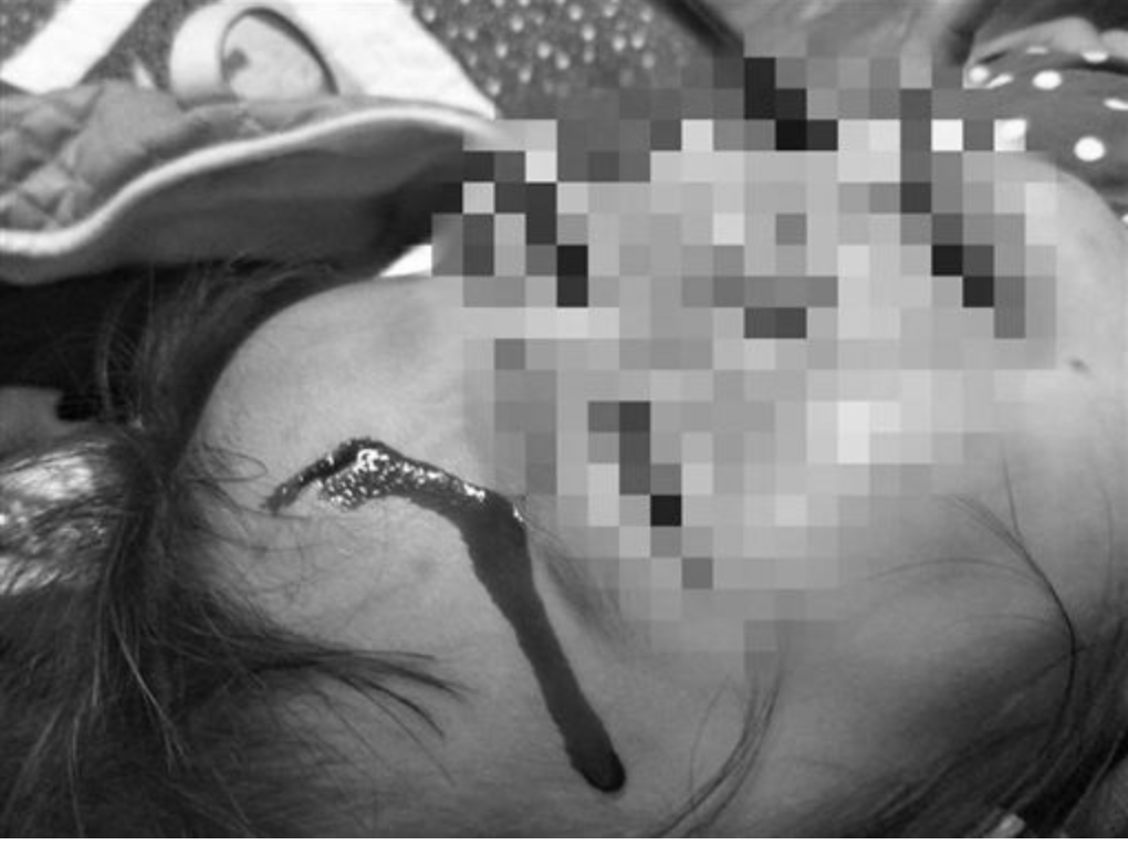 媽媽指責綠島女醫師沒有給予女兒及時治療。 圖：翻攝自就是愛綠島