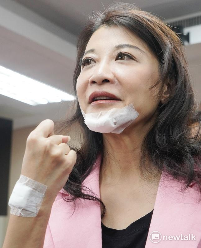 民進黨立委林楚茵今早在內政委員會和國民黨立委爆發激烈肢體衝突，林楚茵的下巴和手肘被抓傷，她在中午現身內政委員會還原衝突過程。 圖：張良一/攝