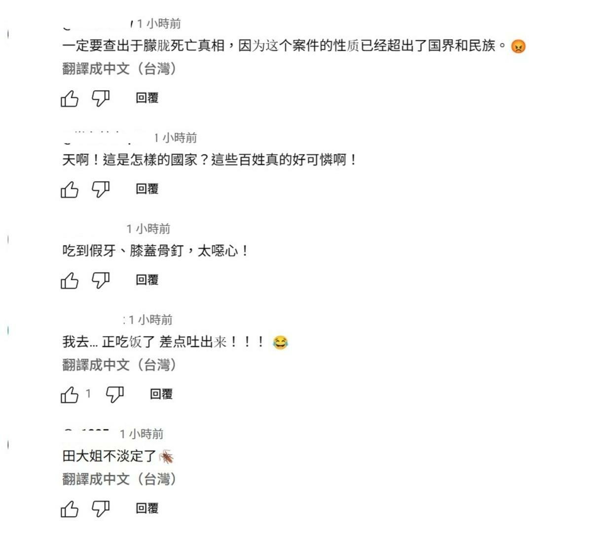 這件事引起很多網友討論，「吃到假牙、膝蓋骨釘，太噁心！」、「正在吃飯 差點吐出來！」 圖：取自YouTube頻道《大宇拍案驚奇》