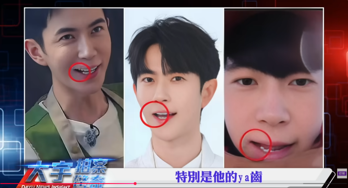 李大宇分析中共回春的黑歷史懷疑，背後的來源和近年中國失蹤人口、于朦朧牙齒被拔掉有關係。 圖：取自YouTube頻道《大宇拍案驚奇》