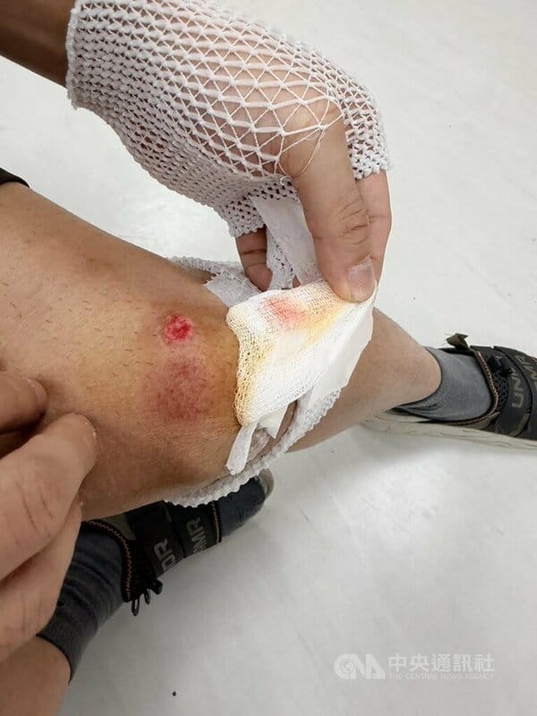 傷害罪通緝犯何姓男子30日在台北市敦化南路一帶遇警盤查、趁機逃逸，警方於追捕過程中受傷，所幸最後仍順利逮捕何男，詢後解送歸案。（翻攝照片）中央社記者黃麗芸傳真　114年11月30日