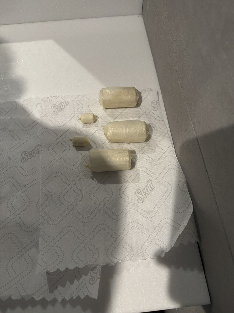 海巡署偵防分署台中查緝隊9月在高雄小港機場查獲2名泰國籍女子，吞食海洛英毒品以人體夾帶方式走私，後到醫院排出多達115顆毒品膠囊。（民眾提供）中央社記者趙麗妍傳真　114年12月11日