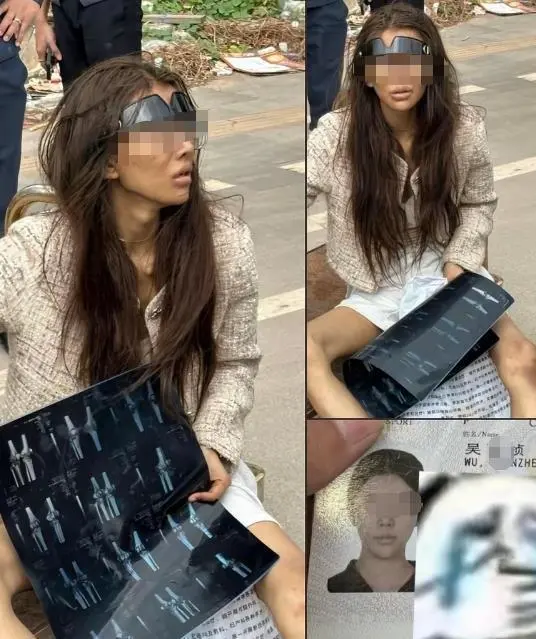 一名福建籍年輕女網紅疑似在柬埔寨街頭流浪，腿部受傷，引起外界關注。 圖：翻攝自 騰訊新聞@極目新聞