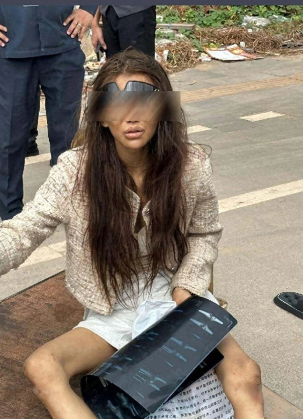福建籍女子吳某楨流落柬埔寨街頭，中國駐柬埔寨使館通報指出，吳某楨自稱因「高薪工作」誘惑赴柬，最終卻身無分文、流落街頭。她目前被安置於西港同濟醫院治療，經檢查診斷出肺部感染、胸腔積水、尿滯留等多項病症，且毛髮藥檢結果顯示，冰毒與 K 他命均呈陽性反應。 圖:翻攝自中國新聞週刊