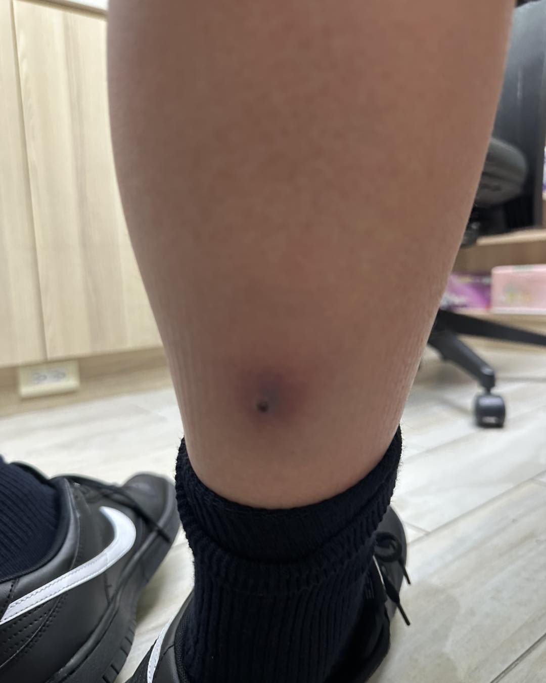 12歲童高燒虛弱喊腳痛，羅士軒醫師機警揪出毒性休克症，緊急轉診救回一命。 圖：翻攝自「旭恩小兒科」診所　臉書專頁