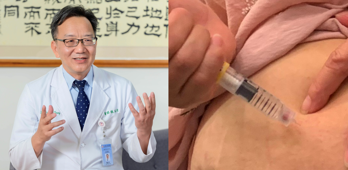 魏正宗教授團隊研究發現，以俗稱瘦瘦針的GLP-1受體促效劑合併使用黃體素，可減少子宮內膜癌風險達 66%。 圖：魏正宗／提供