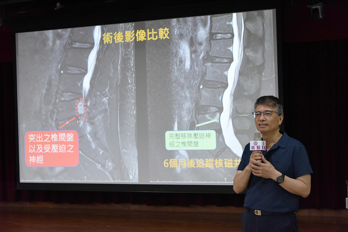 吳先生分享「自由活動」的喜悅。 圖：高醫/提供
