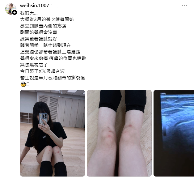 維心近期因膝蓋內側疼痛，緊急前往醫院治療，之後被診斷為「膝蓋半月板和韌帶撕裂傷」。 圖：翻攝自維心Threads