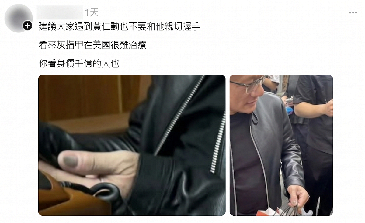16日有網友在Threads貼出黃仁勳手部特寫，指其左手拇指灰黑似瘀青，質疑像灰指甲引發熱議。 圖：翻攝自Threads