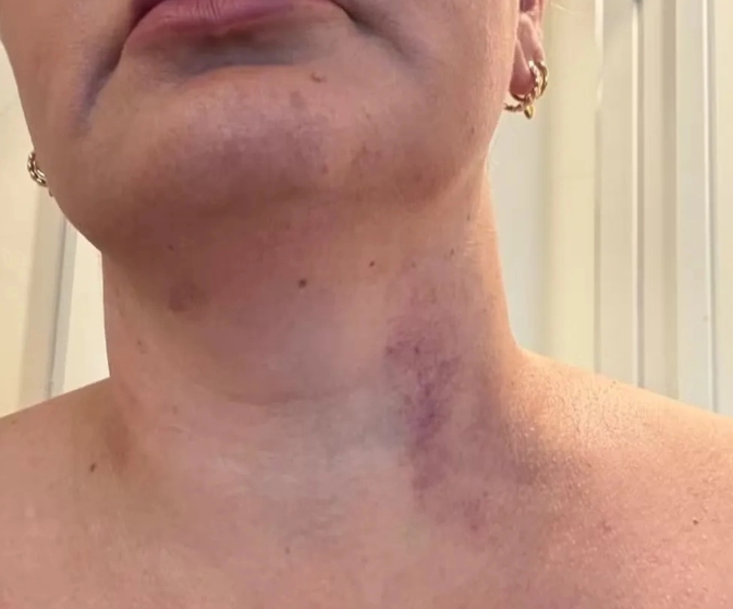 控訴36 歲的維德角隊長萊恩-門德斯涉嫌強姦的女翻譯。 圖 : 翻攝自風過鄉足球精華