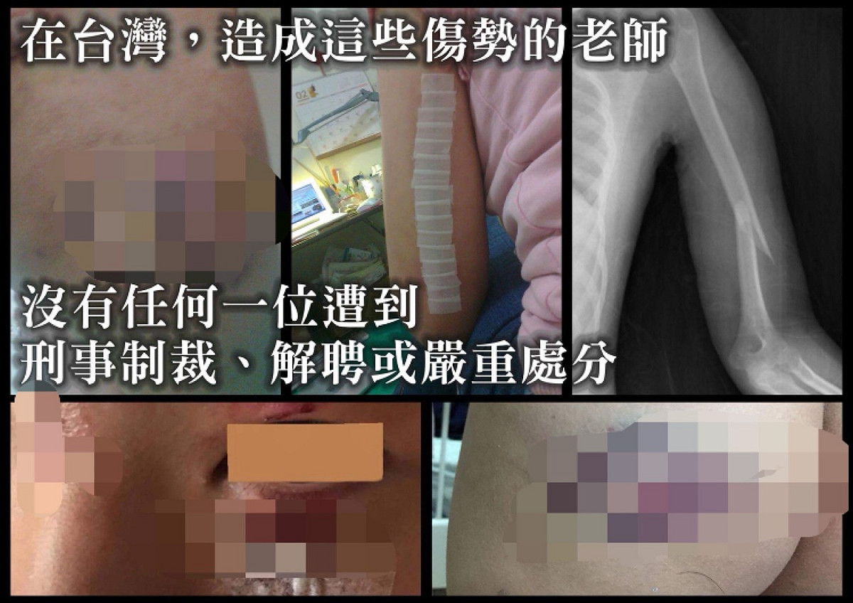 同樣的暴力傷害，對象是成年人時，加害者會負擔刑責。但是，一旦對象變成兒童，這些暴力行為就被認為是「管教」而輕輕放過。 圖：人本教育基金會／提供