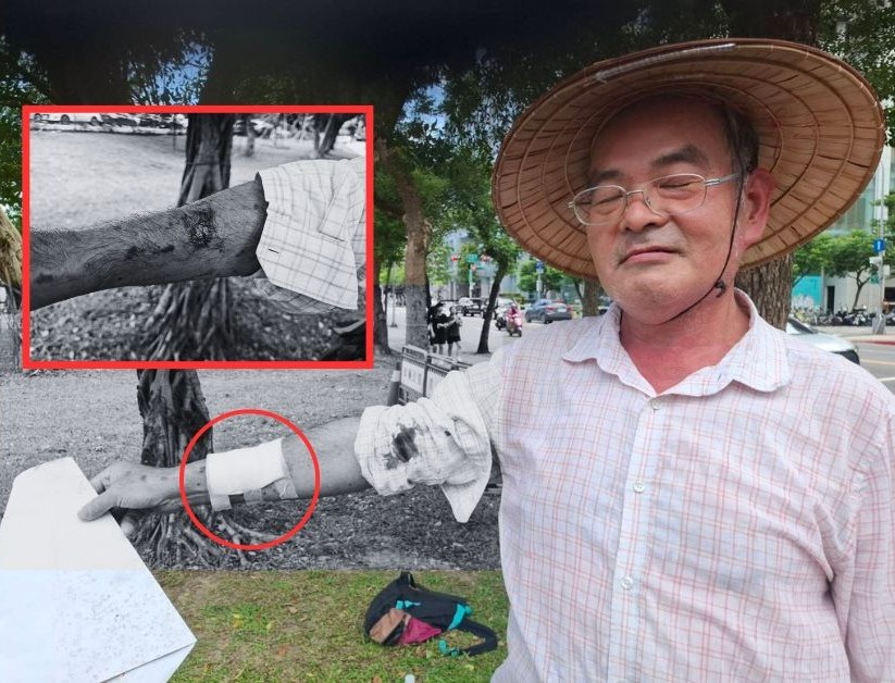 楊木火7月19日前往信義區街頭舉牌陳抗，卻遭警方架離，過程不慎濺血。 圖：楊木火/提供（新頭殼製圖）