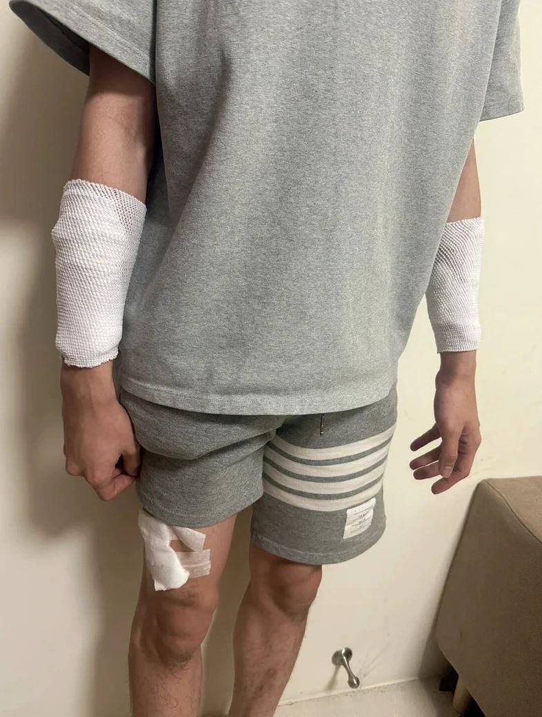 警方調查苗栗隨機砍人案，發現陳姓護理師自導自演，依誣告罪嫌法辦。 圖：翻攝畫面