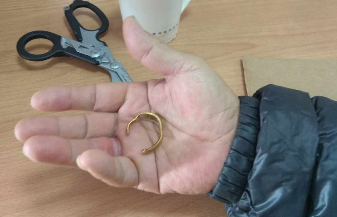 消防隊員剪斷金戒指後，老伯伯的手指重獲自由。 圖 : 嘉義市消防局/提供
