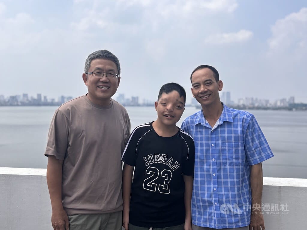 羅慧夫顱顏基金會自1998年開始來越南義診，迄今幫助超過500名孩童重拾正常生活、重建自信。男孩阿清（中）與父親阿雄（右）剛從台灣回來，開心應駐越南代表劉世忠（左）之邀前來慶中秋。中央社記者曾婷瑄河內攝115年9月21日 圖：中央社提供