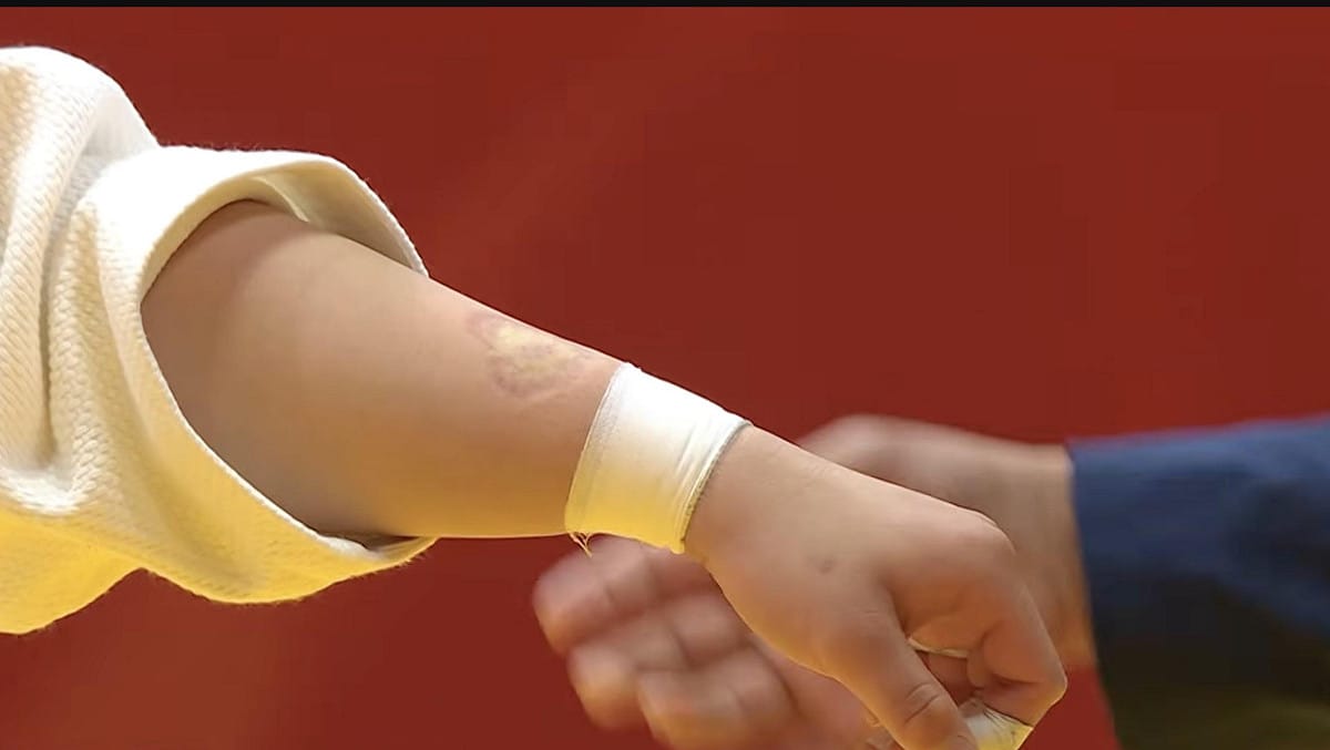 亞運女子柔道中國選手唐婧在與日本選手前田凜纏鬥過程中，竟然用嘴咬了對方手臂。 圖：翻攝自X