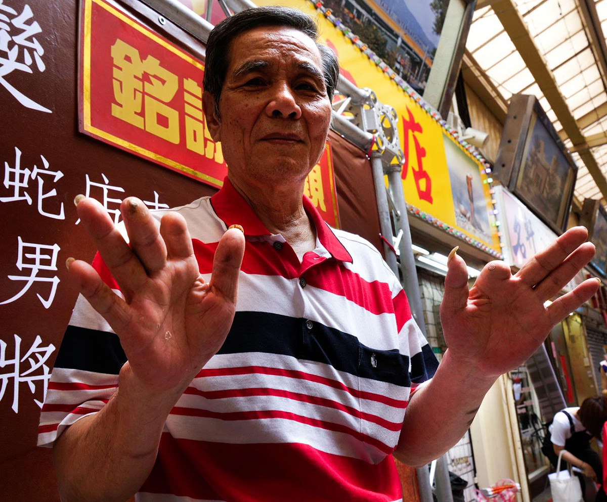 殺蛇師傅洪丁福出示被毒蛇咬到而節去的食指。他的雙手見證了華西街曾經風光一時的蛇街盛況。 圖：張良一/攝