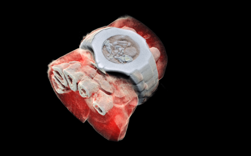 3D彩色立體X光片將改變未來醫療。 圖：翻攝CERN