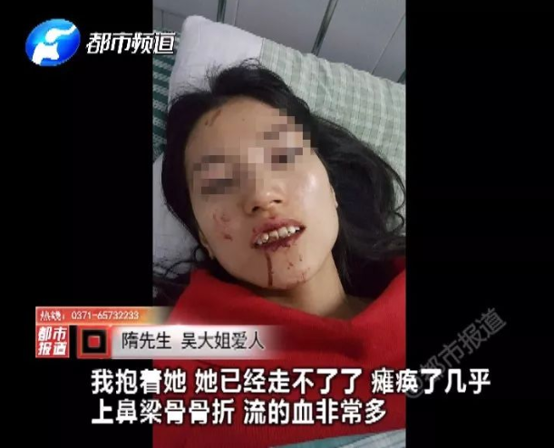 受傷遊客鼻骨骨折，導致滿臉是血。 取自都市頻道