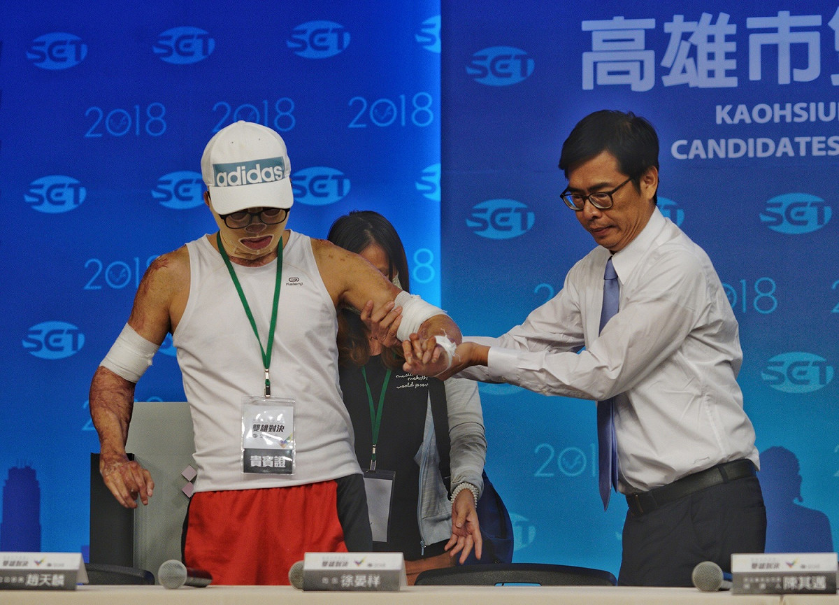 高雄市長電視辯論，民進黨候選人陳其邁會後記者會。陳其邁貼心攙扶高雄氣爆傷者徐晏祥。 圖：張良一/攝