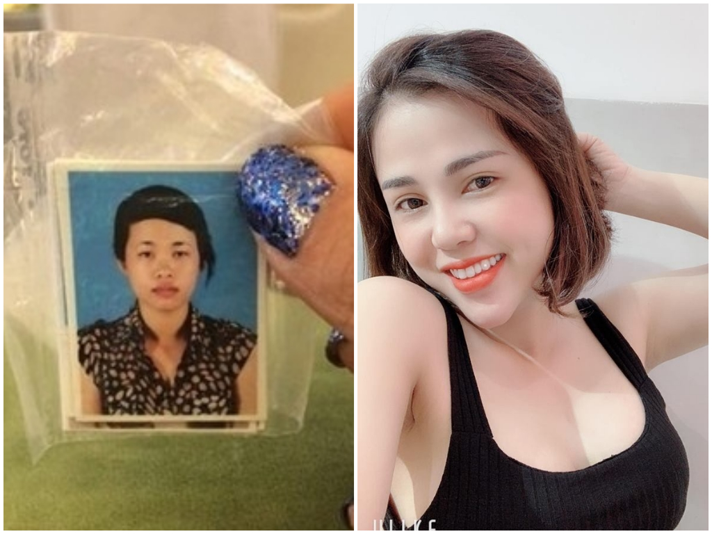 越南一名 28 歲的單親媽，曾因為長相太醜被退婚，如今整形成大正妹。 組圖 / 翻攝自Huyền Nguyễn Nguyễn 臉書