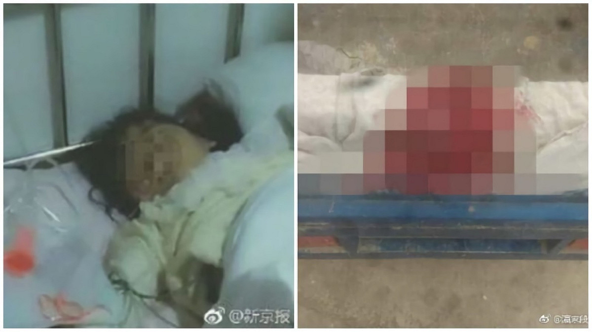 甘肅日前也爆發女童遭虐，8歲女童被老師懷疑偷拿口紅，竟被老師命令同班2名男生用掃帚插傷女童下體。 圖 / 翻攝自新京報