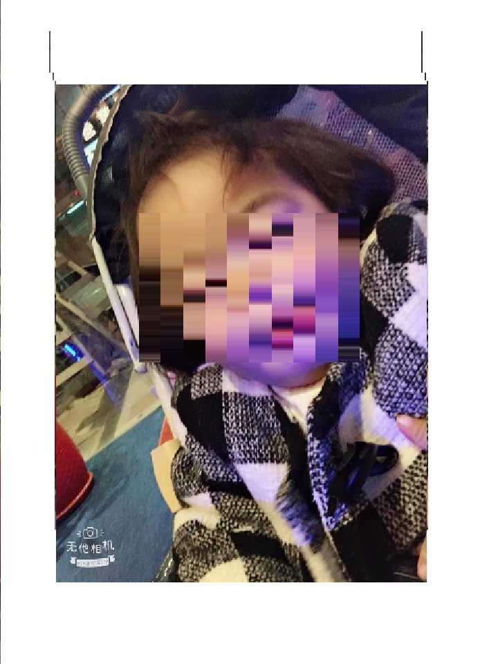 虐童案受害女嬰 圖：翻攝自當事人臉書