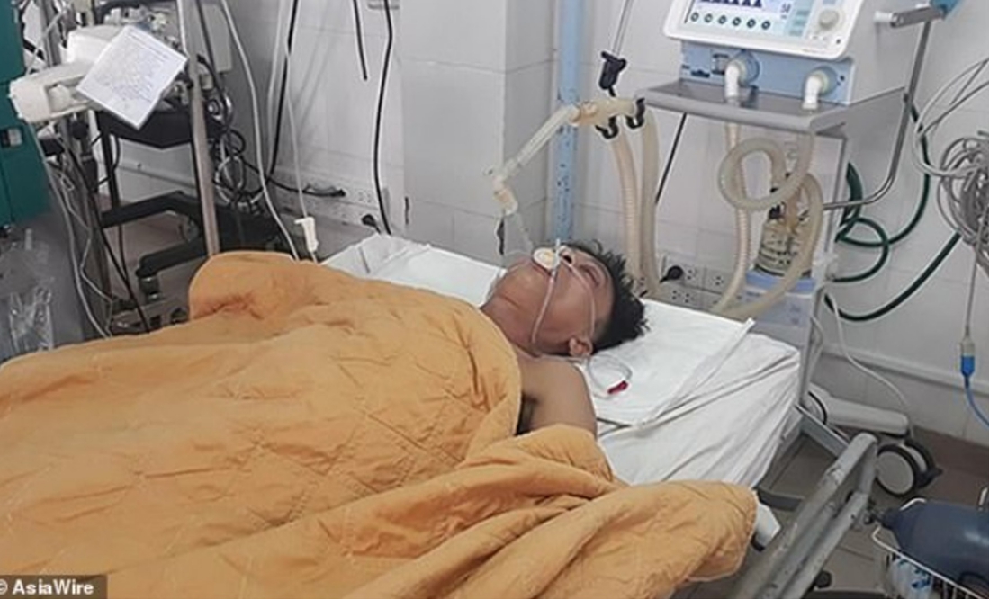 越南一名男子因酒精中毒命危，醫生「以毒攻毒」，注入15瓶啤酒到他體內，成功保住一命。 圖／翻攝DailyMail