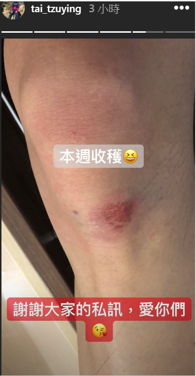 本站雖沒能收獲冠軍，不過小戴打趣道膝蓋上的傷口也是「本週收獲」。 圖：取自戴資穎IG