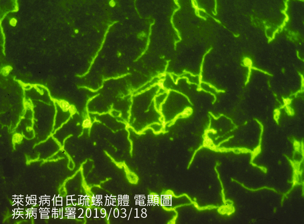 萊姆病伯氏疏螺旋體電顯圖。 圖：疾管署/提供
