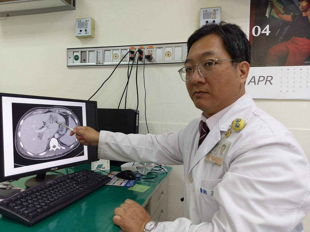 豐原醫院感染科主任王唯堯指肝膿瘍位置。 圖／豐原醫院提供