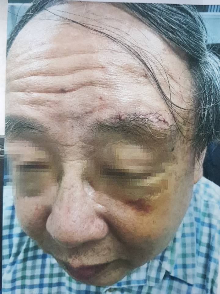 板橋仁愛國宅巷弄道路坑坑洞洞，曾導致彭教授騎腳踏車摔破頭，縫了13針。  圖：葉元之服務處/提供