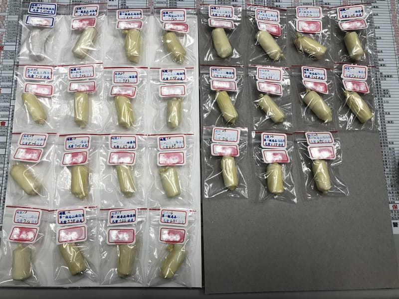 藍姓女子涉嫌擔任人體運毒工具，高雄檢警會同航空警察局在高雄國際機場攔截查獲，帶往醫院以灌腸等方式排出體內海洛因球。 圖 : 翻攝照片