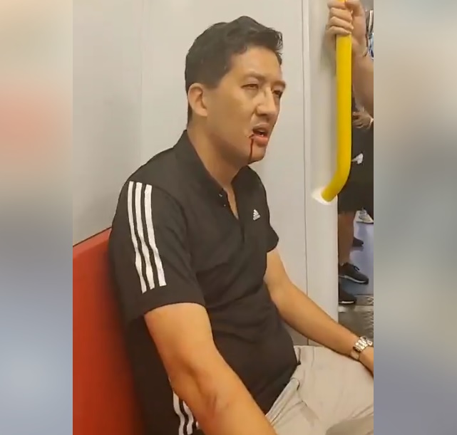 香港民主黨議員林卓廷遭白衣人士攻擊，嘴角濺血。 圖：翻攝自林卓廷臉書