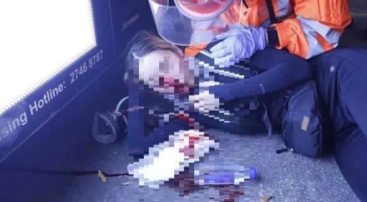 香港「反送中」行動持續，11日晚間傳出港警以布袋彈打穿護目鏡，創傷示威者右眼。 圖：翻攝桑普臉書(資料照片)