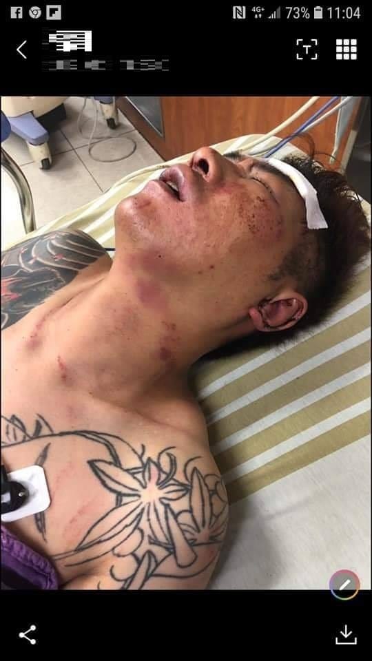 屏東人氣直播主「吳小哲」27日直播進行中遭人擄走失聯，28日被發現遭打斷手腳丟包公園。 圖：翻攝吳小哲探險台臉書