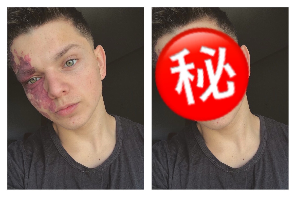 現代人拍照都會常常修圖，不但要有良好的修圖軟體，更要會修圖技術，而修圖不單單只是為了好看，或許還能夠遮瑕。 圖／翻攝自推特