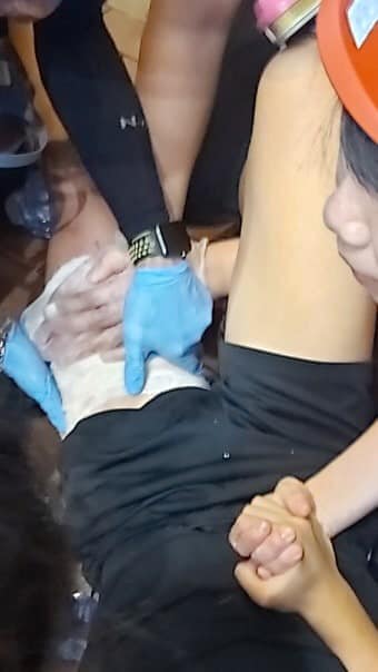 元朗發生14歲男童遭便衣警員開槍射傷左大腿事件。 圖：翻攝Tommy Cheung 張秀賢臉書